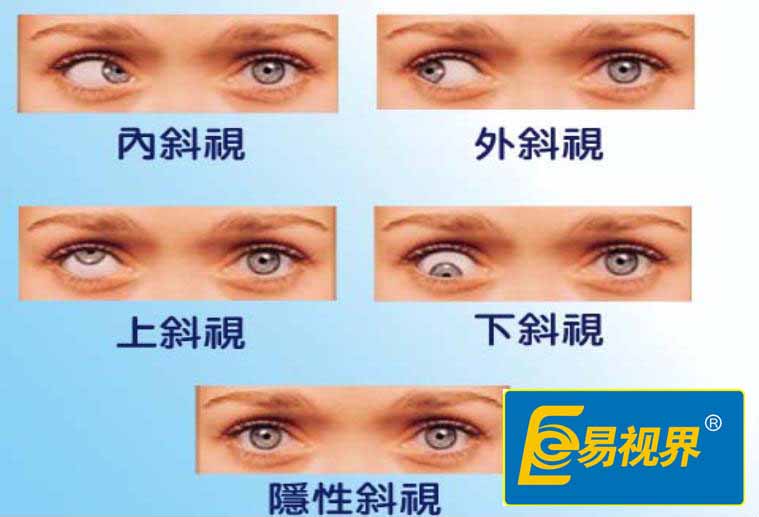 易視界護(hù)眼專家：淺談日常視力保護(hù)
