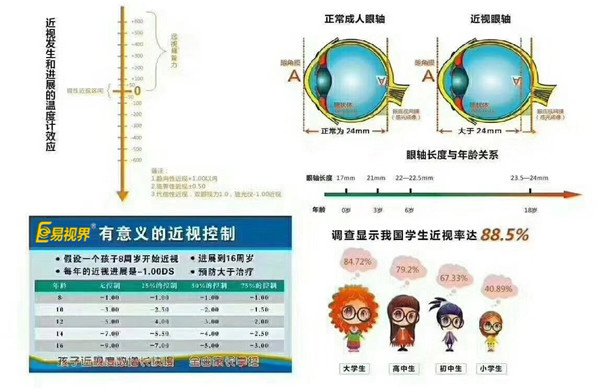 近視的治療和控制非常重要【易視界視力防控中心】