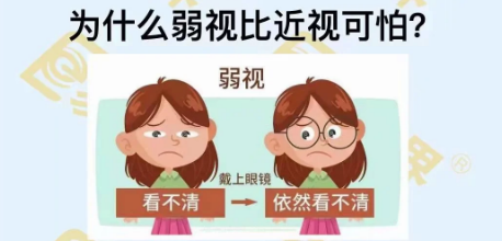 為什么弱視比近視可怕？