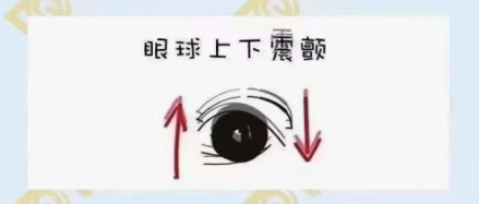 眼球震顫的危害
