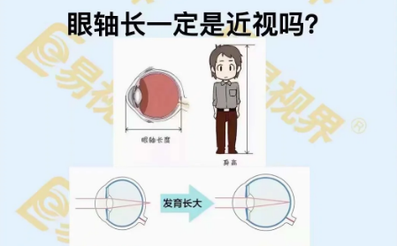 眼軸長一定是近視嗎？