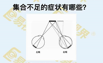 集合不足的癥狀有哪些？